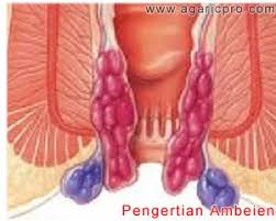 Jual Obat Ambeien Bisa Di Antar Ke Indragiri Hulu