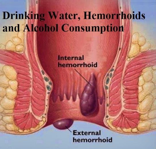 Jual Obat Ambeien Bisa Di Antar Ke Alor